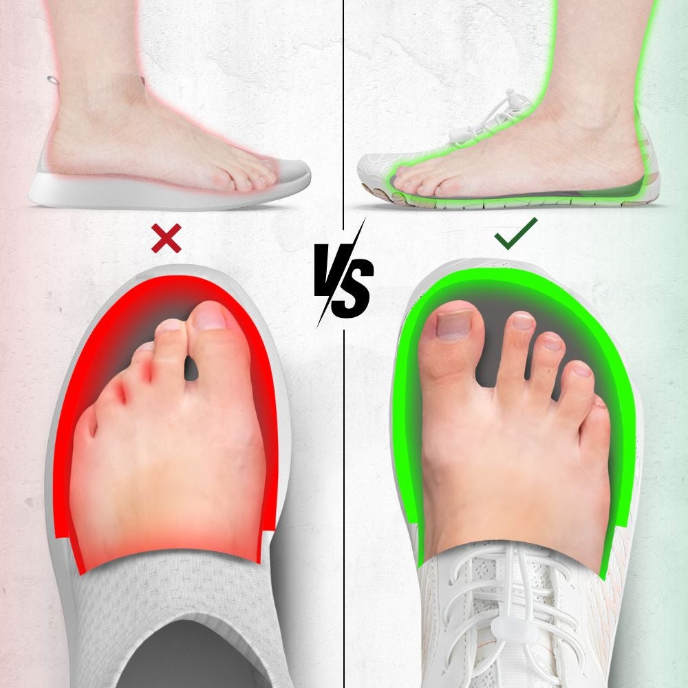 Cartoon illustration of a bunion and the best tennis shoes that fit it